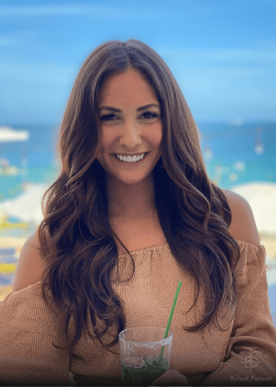 lady smiling with veneers with